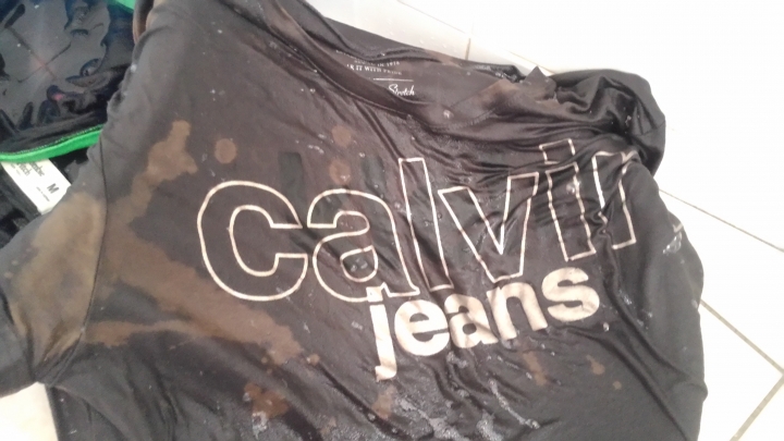 3、全件多處（部分）移染拔除